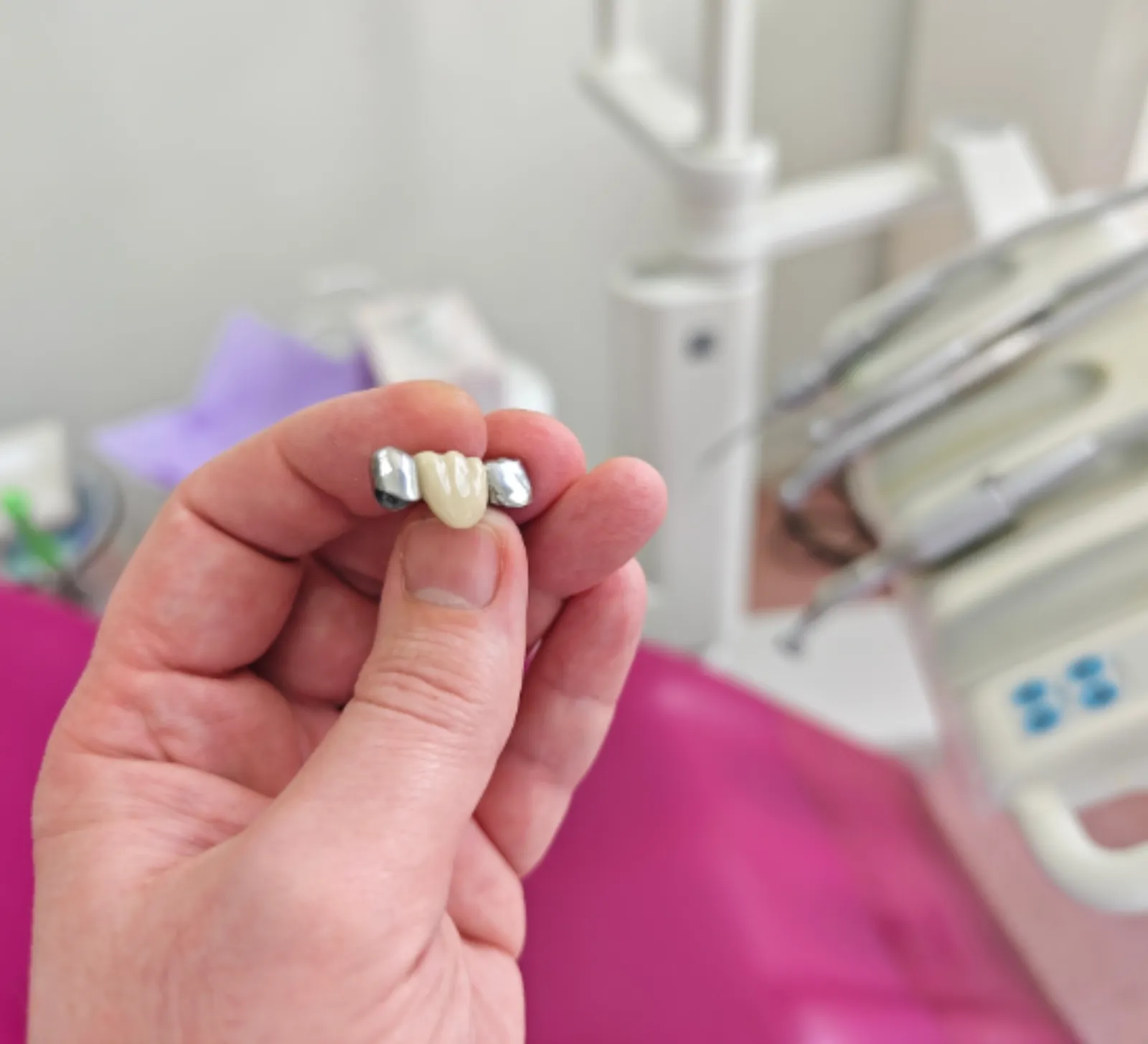Crowns, Bridges & Veneers at High River Dental Centre